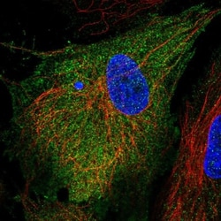 RIAM/APBB1IP Antibody, Novus Biologicals 25 &mu;L, Unlabeled:Antibodies,