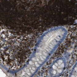 RIAM/APBB1IP Antibody, Novus Biologicals 0.1mL; Unlabeled:Antibodies, Polyclonal