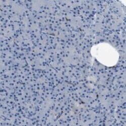 RIAM/APBB1IP Antibody, Novus Biologicals 0.1mL; Unlabeled:Antibodies, Polyclonal