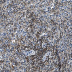 RIAM/APBB1IP Antibody, Novus Biologicals 0.1mL; Unlabeled:Antibodies, Polyclonal