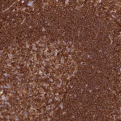 RIAM/APBB1IP Antibody, Novus Biologicals 25 &mu;L, Unlabeled:Antibodies,