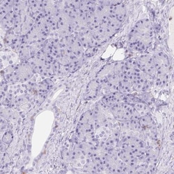RIAM/APBB1IP Antibody, Novus Biologicals 25 &mu;L, Unlabeled:Antibodies,