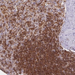 RIAM/APBB1IP Antibody, Novus Biologicals 25 &mu;L, Unlabeled:Antibodies,