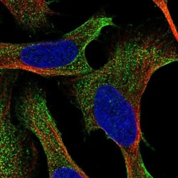 RIIAD1 Antibody, Novus Biologicals 25 &mu;L, Unlabeled:Antibodies, Polyclonal