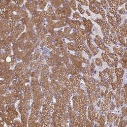 RIIAD1 Antibody, Novus Biologicals 25 &mu;L, Unlabeled:Antibodies, Polyclonal