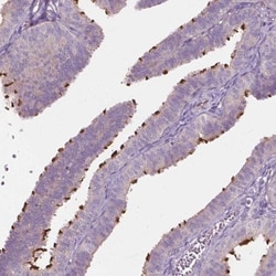 RIIAD1 Antibody, Novus Biologicals 25 &mu;L, Unlabeled:Antibodies, Polyclonal