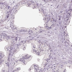 RIIAD1 Antibody, Novus Biologicals 25 &mu;L, Unlabeled:Antibodies, Polyclonal