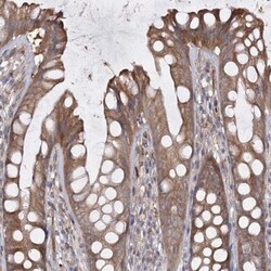 RIN2 Antibody, Novus Biologicals 0.1mL; Unlabeled:Antibodies, Polyclonal