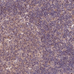 RINL Antibody, Novus Biologicals 0.1mL; Unlabeled:Antibodies, Polyclonal