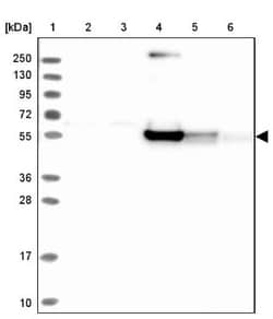 RINL Antibody, Novus Biologicals 0.1mL; Unlabeled:Antibodies, Polyclonal