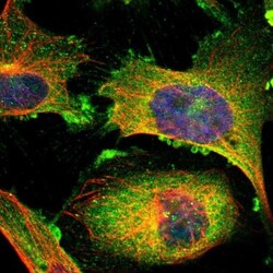 RIOK2 Antibody, Novus Biologicals:Antibodies:Primary Antibodies