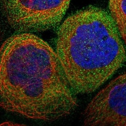 RIPK1/RIP1 Antibody, Novus Biologicals:Antibodies:Primary Antibodies