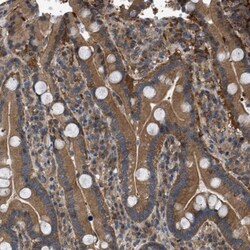 RIPK1/RIP1 Antibody, Novus Biologicals:Antibodies:Primary Antibodies