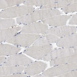 RIPK1/RIP1 Antibody, Novus Biologicals:Antibodies:Primary Antibodies