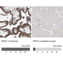 RIPK1/RIP1 Antibody, Novus Biologicals:Antibodies:Primary Antibodies