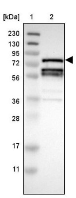 RIPK1/RIP1 Antibody, Novus Biologicals:Antibodies:Primary Antibodies
