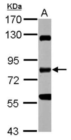 RIPK1/RIP1 Antibody, Novus Biologicals 0.1mL; Unlabeled:Anticorps, Polyclonal