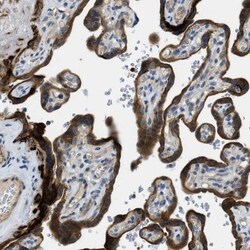 RIPK2 Antibody, Novus Biologicals 0.1mL; Unlabeled:Antibodies, Polyclonal