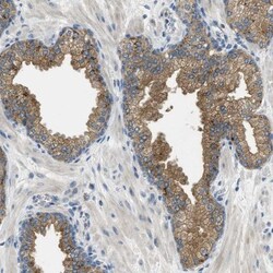 RIPK2 Antibody, Novus Biologicals 0.1mL; Unlabeled:Antibodies, Polyclonal