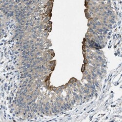 RIPK2 Antibody, Novus Biologicals 0.1mL; Unlabeled:Antibodies, Polyclonal