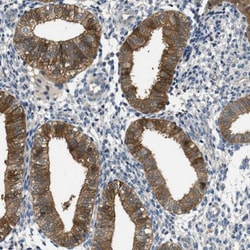 RIPK2 Antibody, Novus Biologicals 0.1mL; Unlabeled:Antibodies, Polyclonal