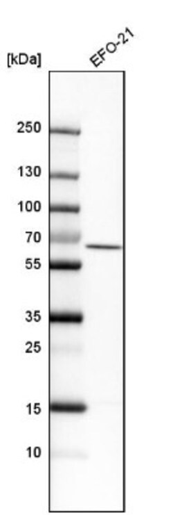 RIPK2 Antibody, Novus Biologicals 0.1mL; Unlabeled:Antibodies, Polyclonal