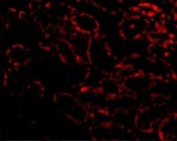 RIPK3/RIP3 Antibody - BSA Free, Novus Biologicals 0.1mg; Unlabeled:Antibodies,