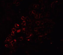 RIPK3/RIP3 Antibody - BSA Free, Novus Biologicals 0.1mg; Unlabeled:Antibodies,