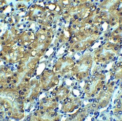 RIPK3/RIP3 Antibody - BSA Free, Novus Biologicals 0.1mg; Unlabeled:Antibodies,