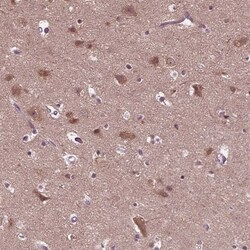 RIPX Antibody, Novus Biologicals 0.1mL; Unlabeled:Antibodies, Polyclonal