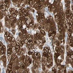 RKIP/PBP Antibody, Novus Biologicals 0.1mL; Unlabeled:Antibodies, Polyclonal