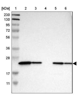 RKIP/PBP Antibody, Novus Biologicals 0.1mL; Unlabeled:Antibodies, Polyclonal