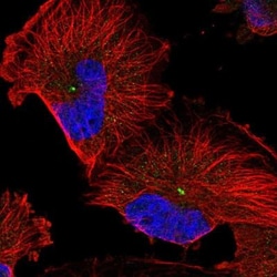 RMD1 Antibody, Novus Biologicals 0.1mL; Unlabeled:Antibodies, Polyclonal