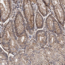RMD1 Antibody, Novus Biologicals 0.1mL; Unlabeled:Antibodies, Polyclonal