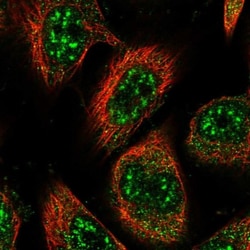 RMI2 Antibody, Novus Biologicals:Antibodies:Primary Antibodies