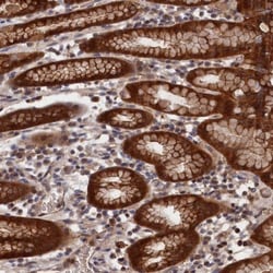 RMI2 Antibody, Novus Biologicals:Antibodies:Primary Antibodies
