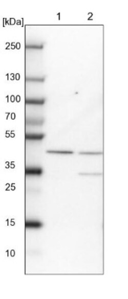 RMND5B Antibody, Novus Biologicals:Antibodies:Primary Antibodies