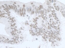 RNA Helicase A Antibody, Novus Biologicals 0.1mL; Unlabeled:Antibodies,