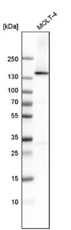 RNA Helicase A Antibody, Novus Biologicals 0.1mL; Unlabeled:Antikörper