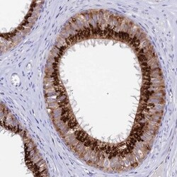 RNASE12 Antibody, Novus Biologicals 0.1mL; Unlabeled:Antibodies, Polyclonal