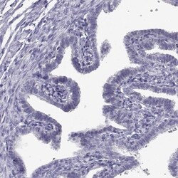 RNASE12 Antibody, Novus Biologicals 0.1mL; Unlabeled:Antibodies, Polyclonal