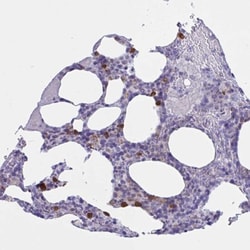 RNASE3 Antibody, Novus Biologicals 25 &mu;L, Unlabeled:Antibodies, Polyclonal