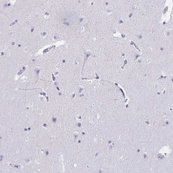 RNASE3 Antibody, Novus Biologicals 25 &mu;L, Unlabeled:Antibodies, Polyclonal