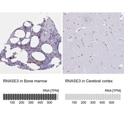 RNASE3 Antibody, Novus Biologicals 25 &mu;L, Unlabeled:Antibodies, Polyclonal