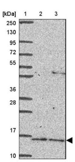 RNASE3 Antibody, Novus Biologicals 25 &mu;L, Unlabeled:Antibodies, Polyclonal