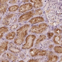 RNASE7 Antibody, Novus Biologicals 25 &mu;L, Unconjugated:Antibodies, Polyclonal