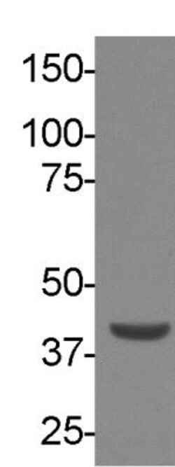 RNASEH2B Antibody (673), Novus Biologicals 0.1mL; Unlabeled:Antibodies,