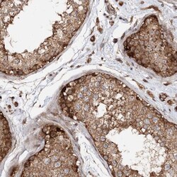 RNF111 Antibody, Novus Biologicals:Antibodies:Primary Antibodies