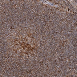 RNF111 Antibody, Novus Biologicals:Antibodies:Primary Antibodies