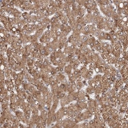 RNF111 Antibody, Novus Biologicals:Antibodies:Primary Antibodies